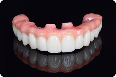 Керамокомпозитный протез на имплантах